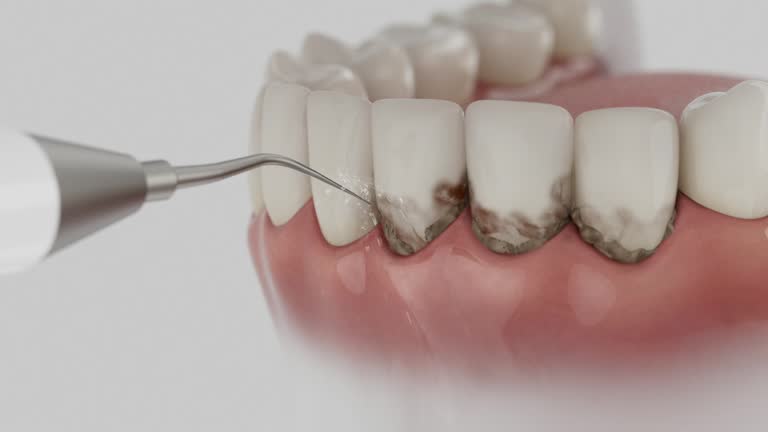 Trusted Teeth Cleaning And Checkup service in Munday, TX - Dentist Open Now